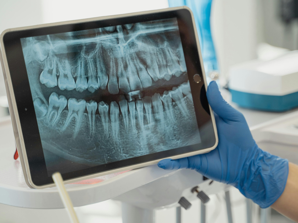 Radiografía dental mostrada en una tableta durante una consulta