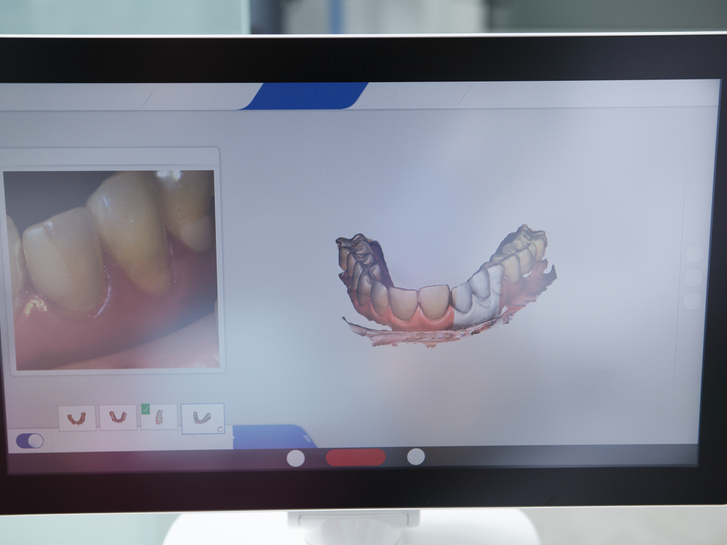 Simulador dental que muestra un modelo digital tridimensional